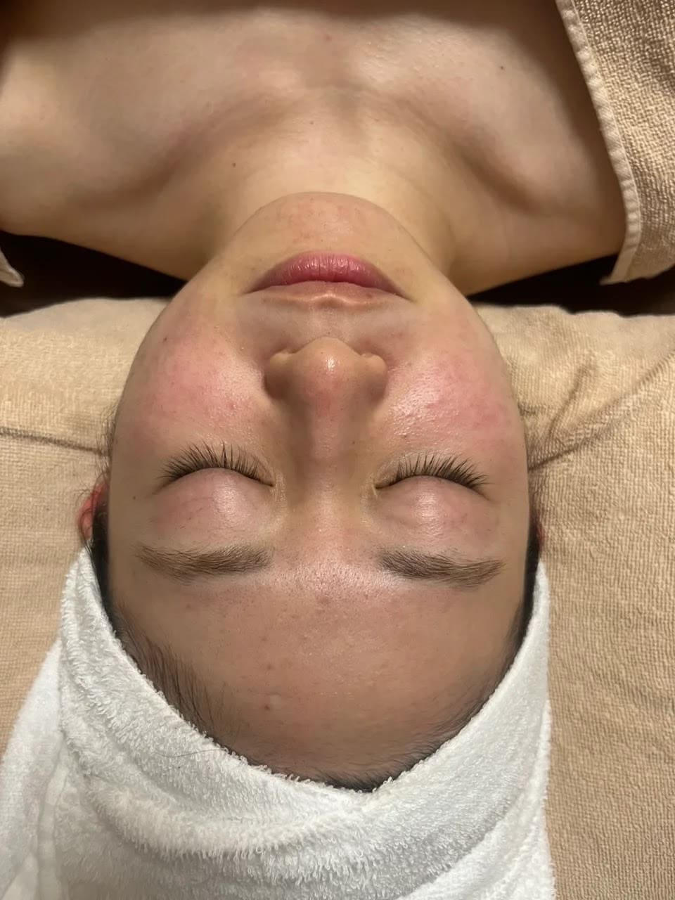 女性ビフォー